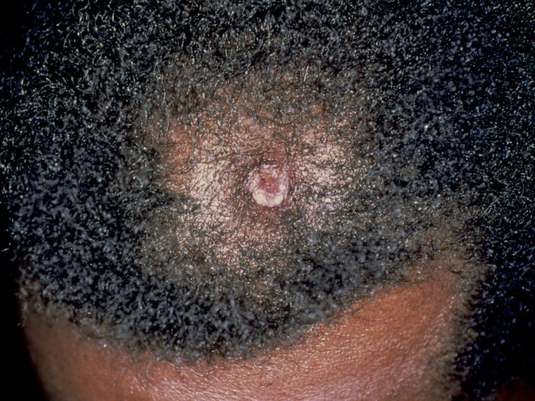 The Skin of Color Revolution in Dermatology: Crucial Lessons Learned ...